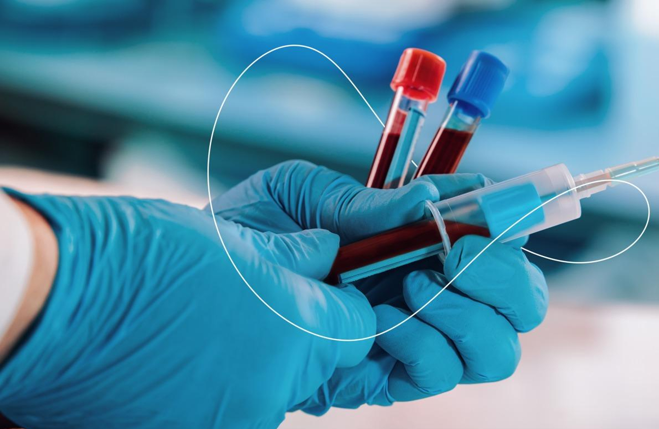 Como calcular o jejum para fazer exame de sangue de diferentes tipos